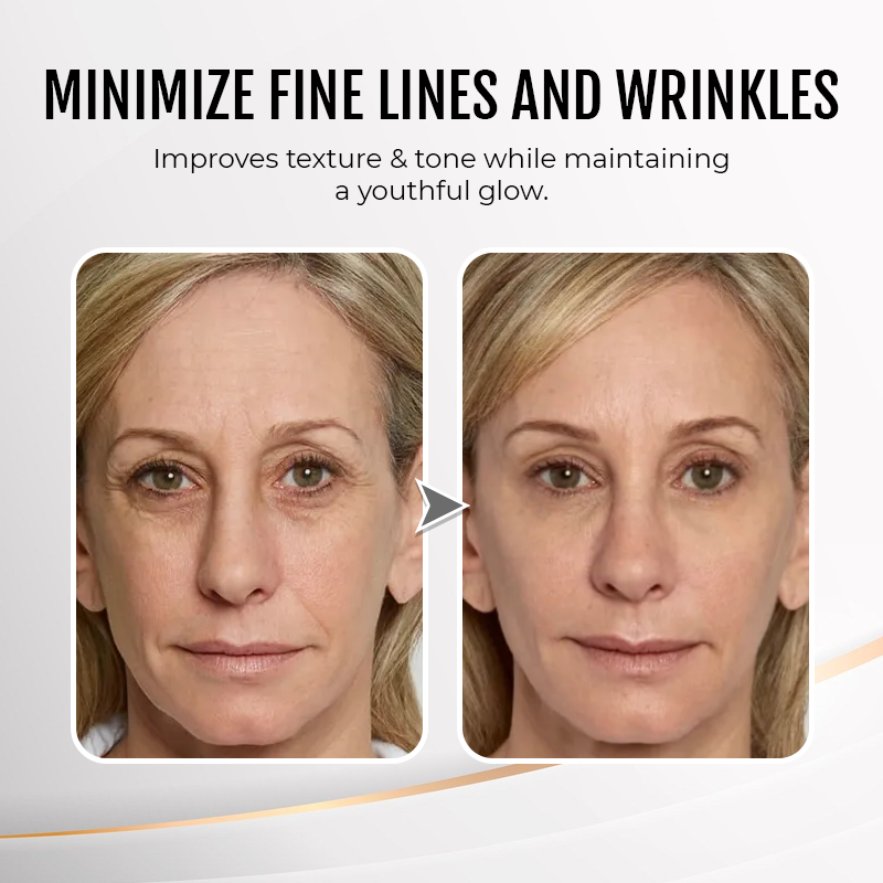 Final 3 Hours: 60% OFF🔥 Instant Wrinkle Eye Tightener cream