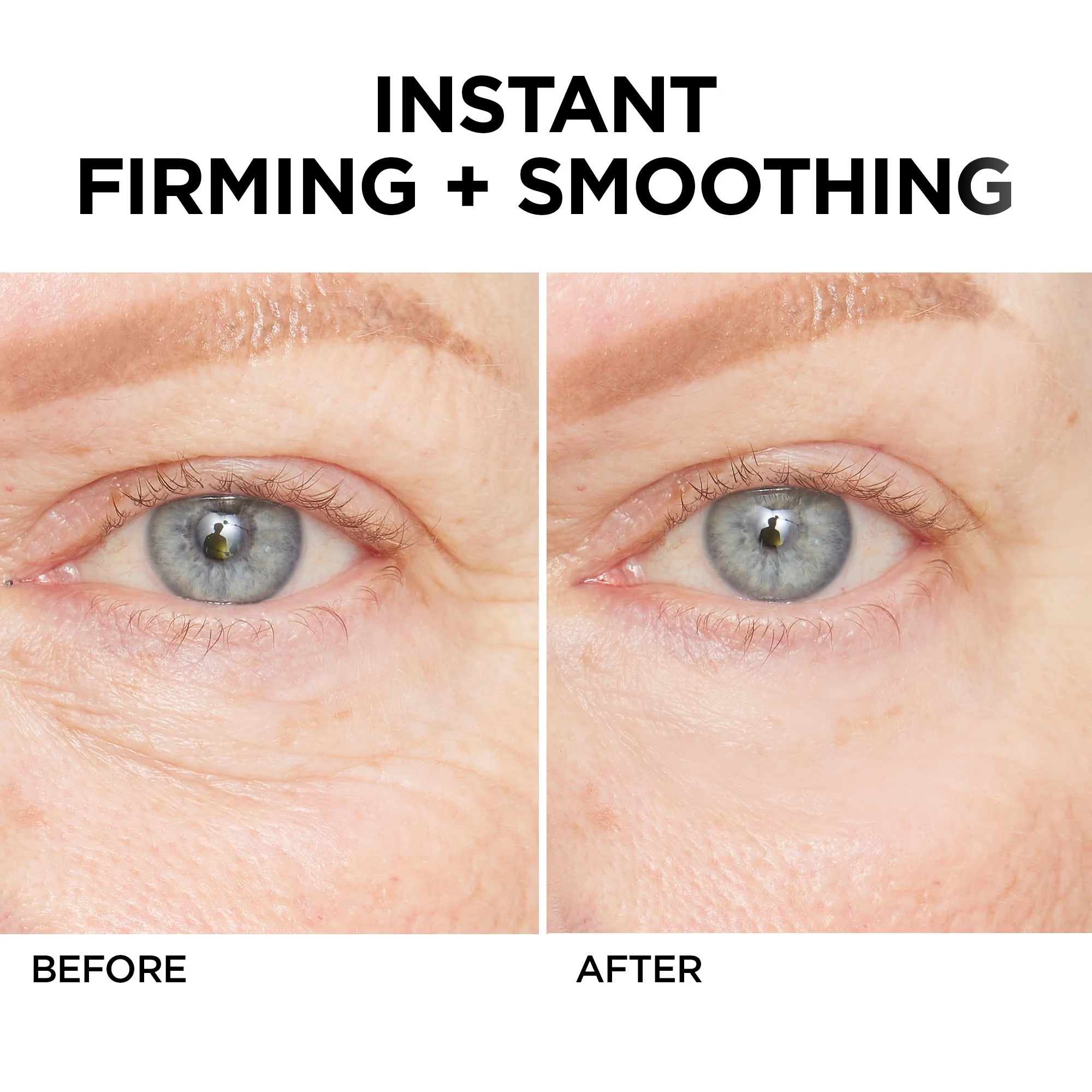 Final 3 Hours: 60% OFF🔥 Instant Wrinkle Eye Tightener cream